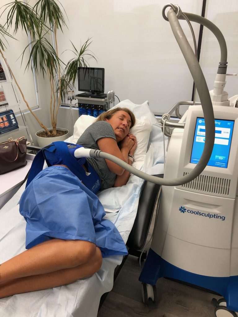 All About The Coolsculpting Treatment kimmershow