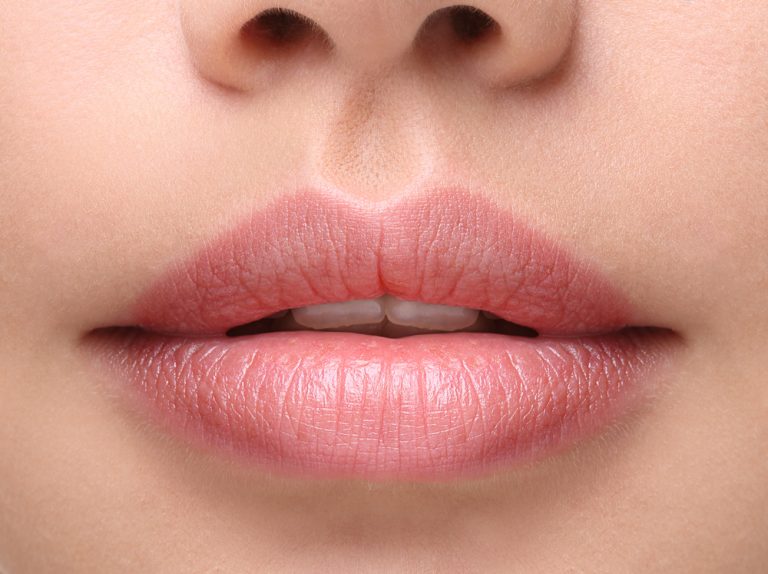 A Guide To Restylane Kysse The Newest, LongestLasting Lip Filler