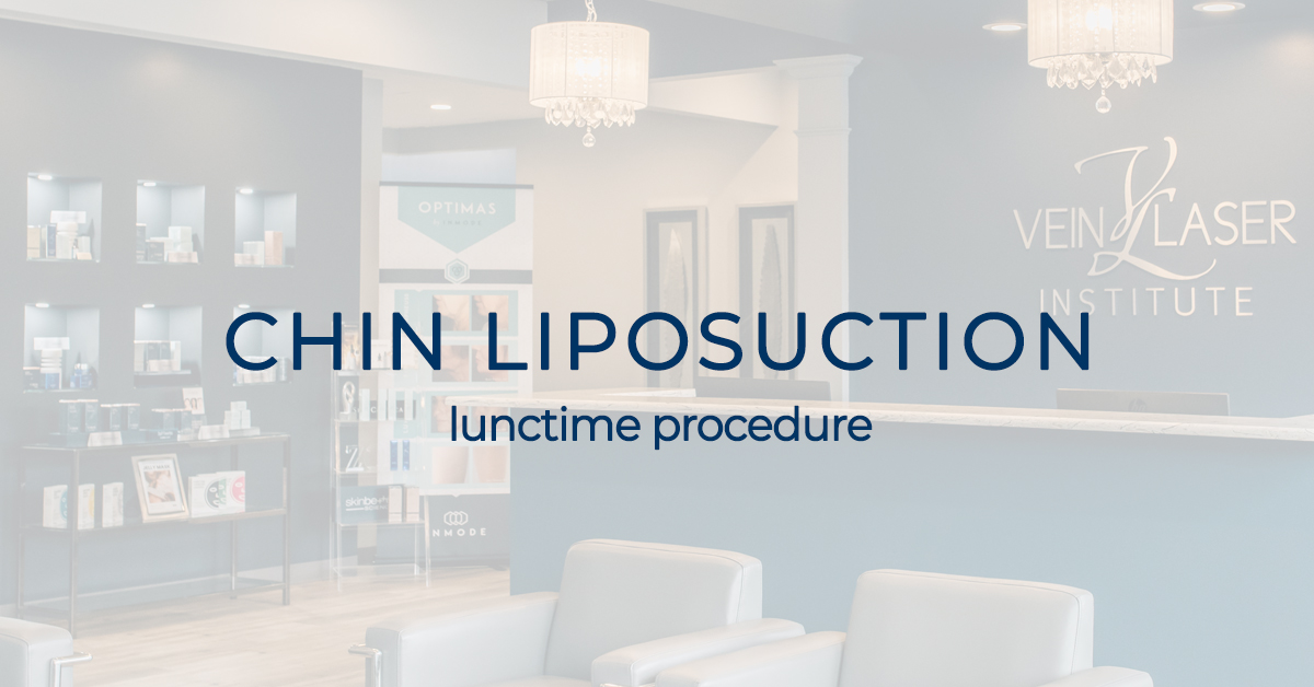 chin liposuction