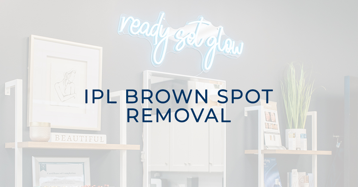 ipl brown spot removal