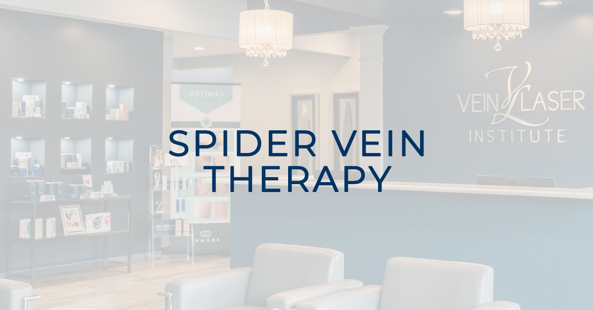 spider vein treatments