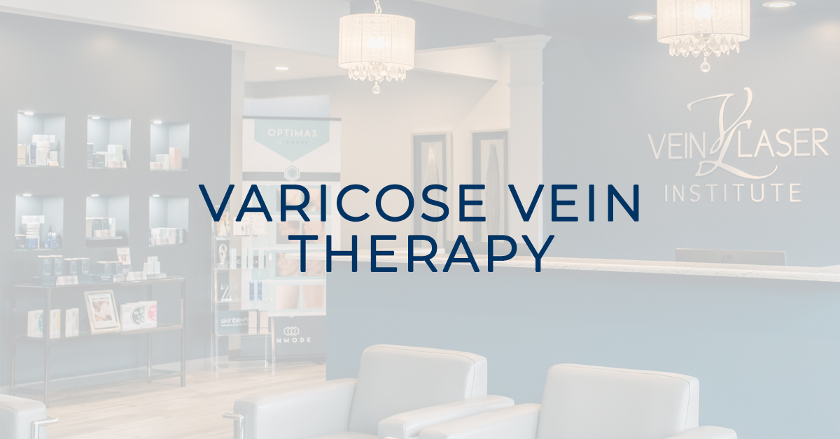 varicose vein treatments